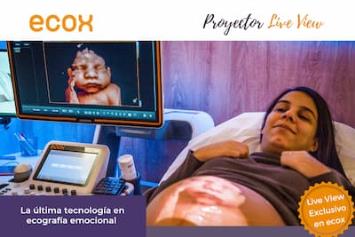 Ecox 5D, ecografía emocional a embarazadas, inaugura nueva franquicia en Tenerife Sur-Adeje