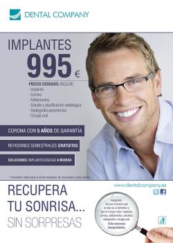 La franquicia Dental Company habla claro sobre los implantes