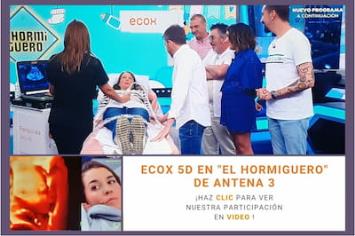 La cadena de Ecografías 5D para embarazadas en El Hormiguero